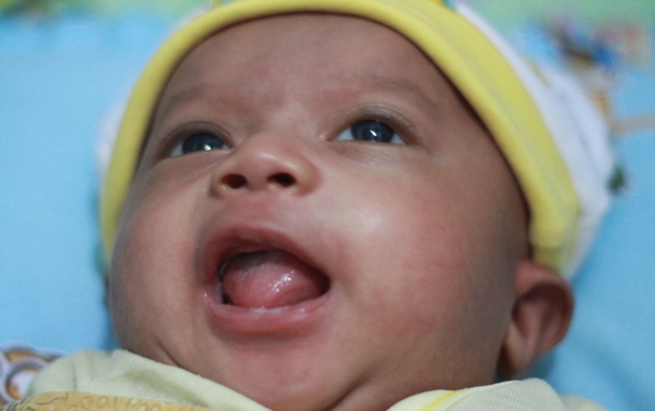 lidah-putih-pada-bayi